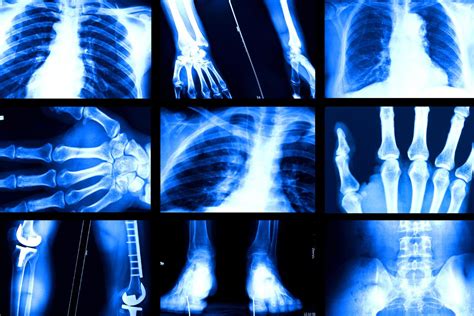 sextudy group|Study reveals why AI models that analyze medical images can be .